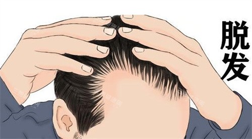 西宁碧莲盛植发预约全攻略：微信小程序＋官网＋电话三通道，24小时客服秒回！