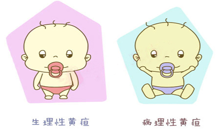 新生儿黄疸病理性和生理性