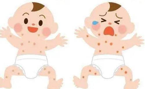新生宝宝湿疹
