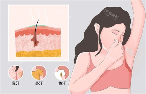 商丘韩艺狐臭有哪些症状