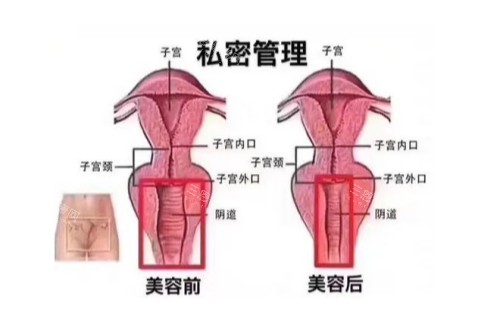 私密管理前后对比图 私密管理前后对比图