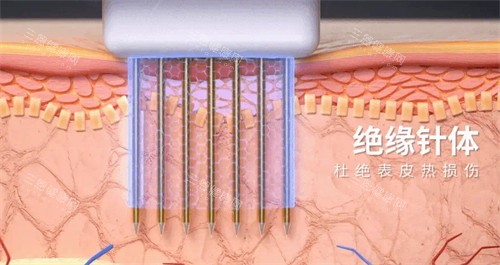 本顏皮膚科術後效果對比