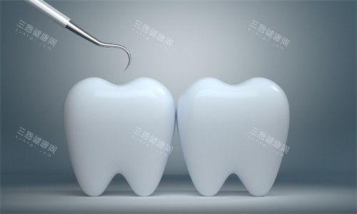 牙齿检查