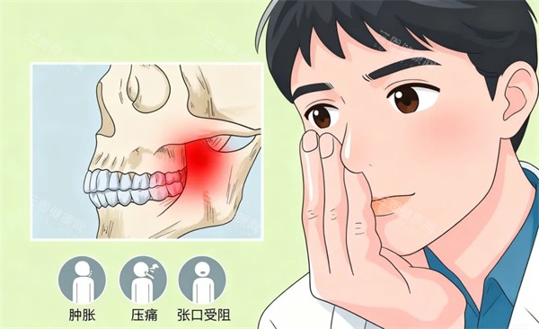 牙齿问题