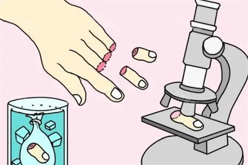 断指手术卡通图 断指手术卡通图