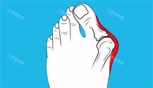 大脚骨是什么