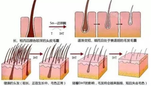 毛囊的不同健康情况 毛囊的不同健康情况