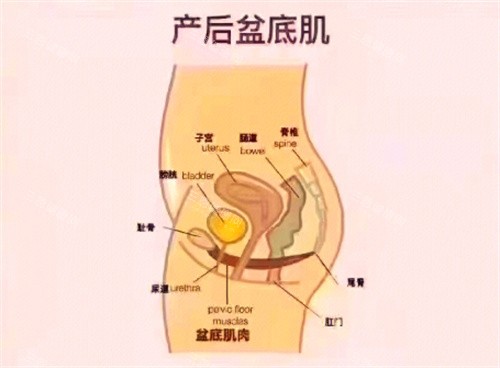 产后盆底肌