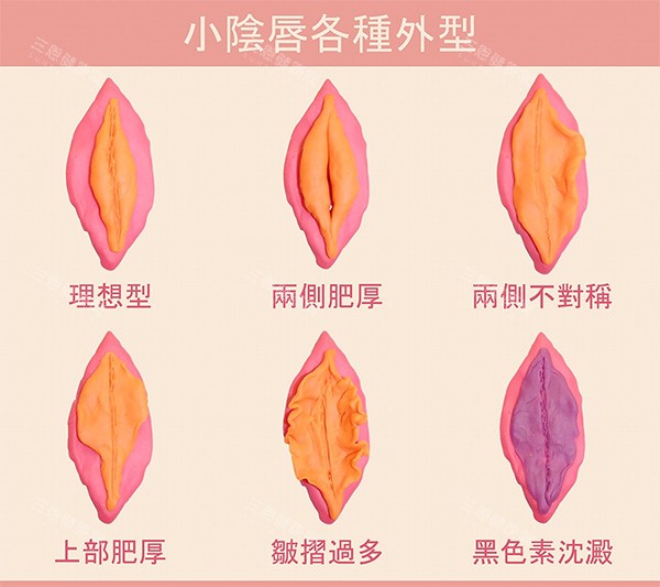 不同女性私密阴唇照片
