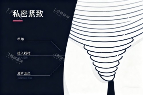 紧密紧缩卡通图